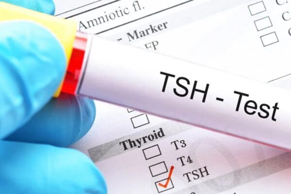 TSH Nedir? Kaç Olmalıdır? 2025