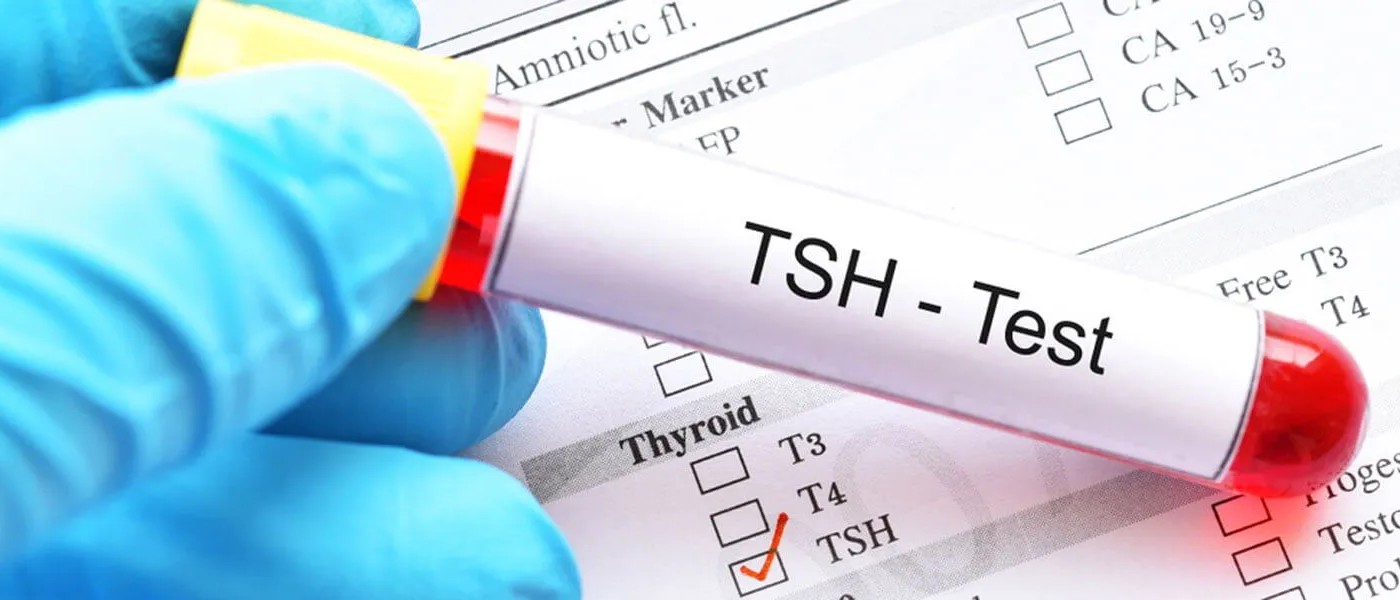 TSH Nedir? Kaç Olmalıdır? 2025